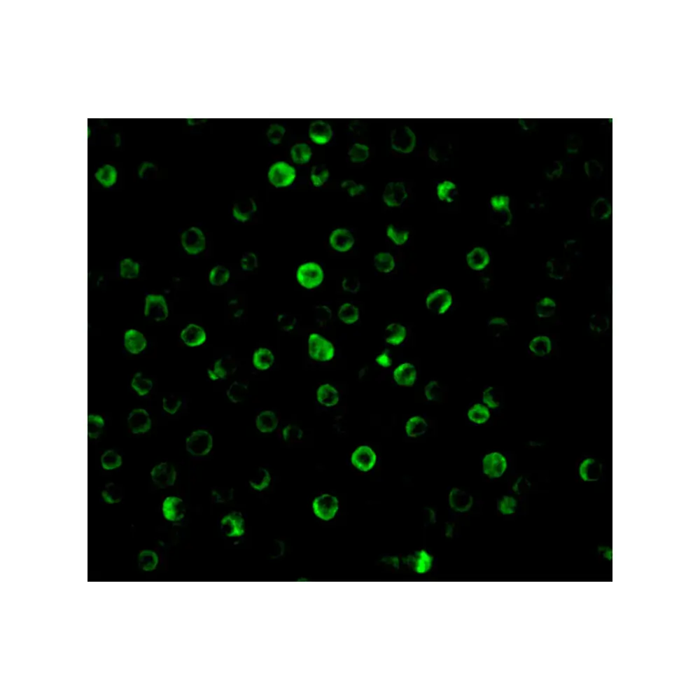 ProSci 2497_S IL-22 Receptor Antibody, ProSci, 0.02 mg/Unit Tertiary Image