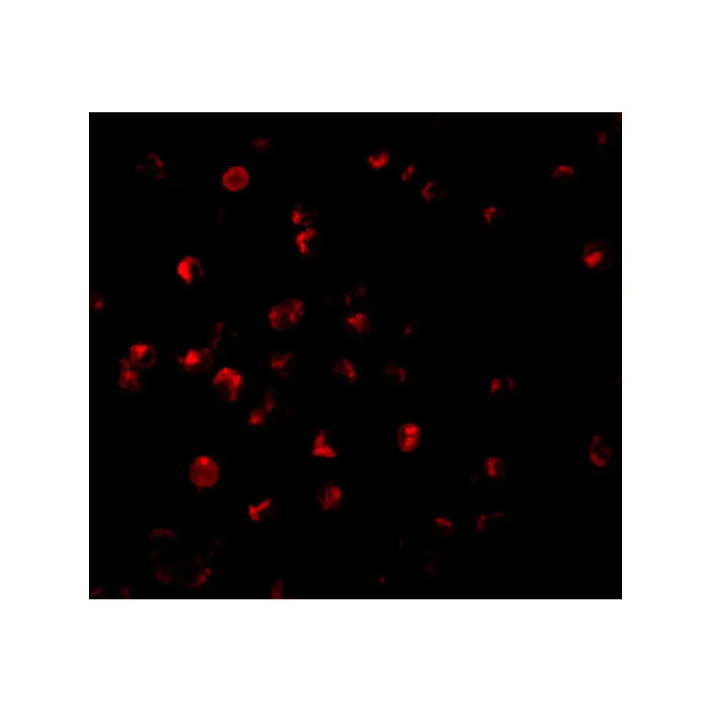 ProSci 3017 ILP-2 Antibody, ProSci, 0.1 mg/Unit Tertiary Image