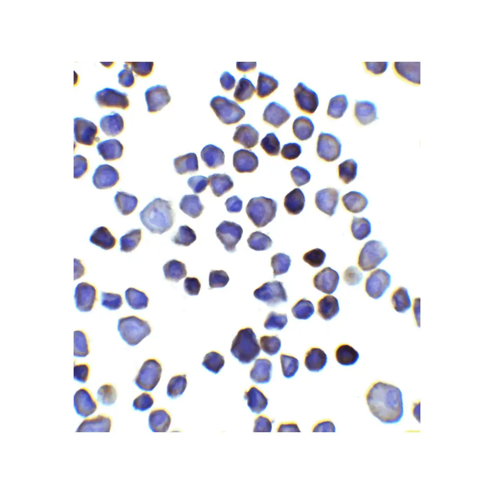 ProSci 8339_S INPP4B Antibody, ProSci, 0.02 mg/Unit Secondary Image