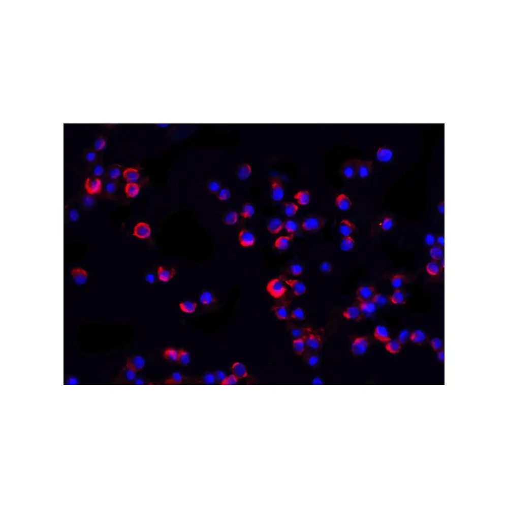 ProSci 3595 IRAK2 Antibody, ProSci, 0.1 mg/Unit Quaternary Image