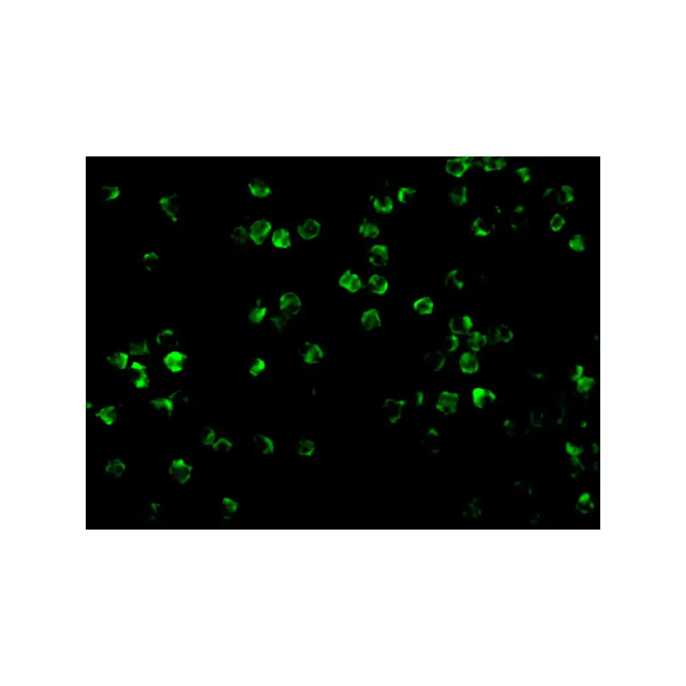 ProSci 3595_S IRAK2 Antibody, ProSci, 0.02 mg/Unit Tertiary Image