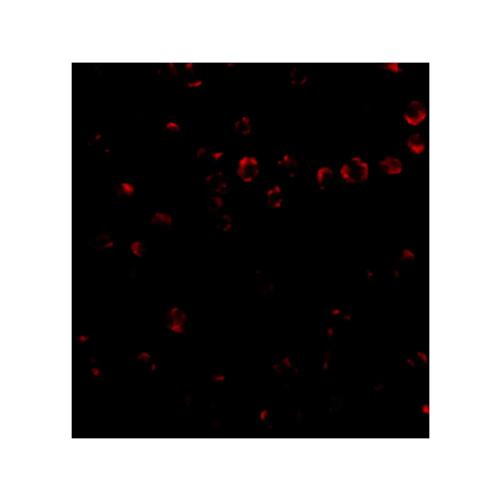 ProSci 4827 Integrin alpha 4 Antibody, ProSci, 0.1 mg/Unit Secondary Image