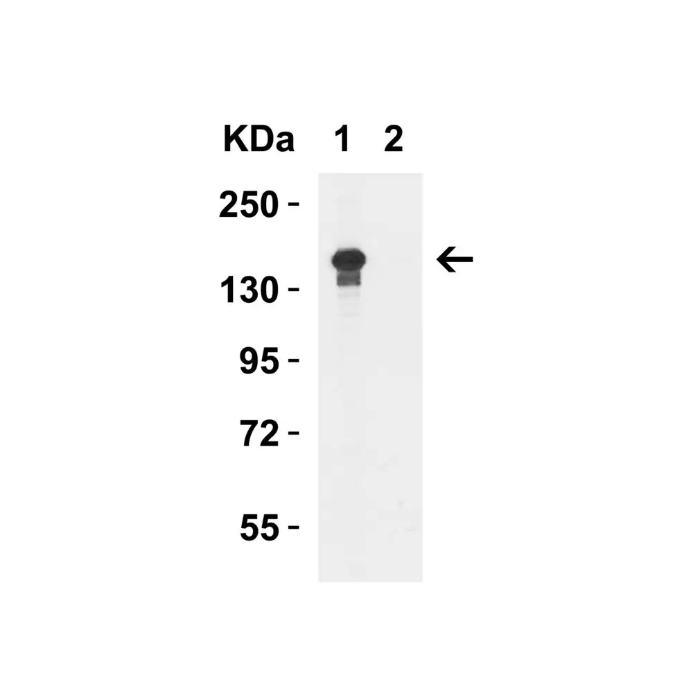 ProSci 6657_S JMJD3 Antibody, ProSci, 0.02 mg/Unit Quaternary Image