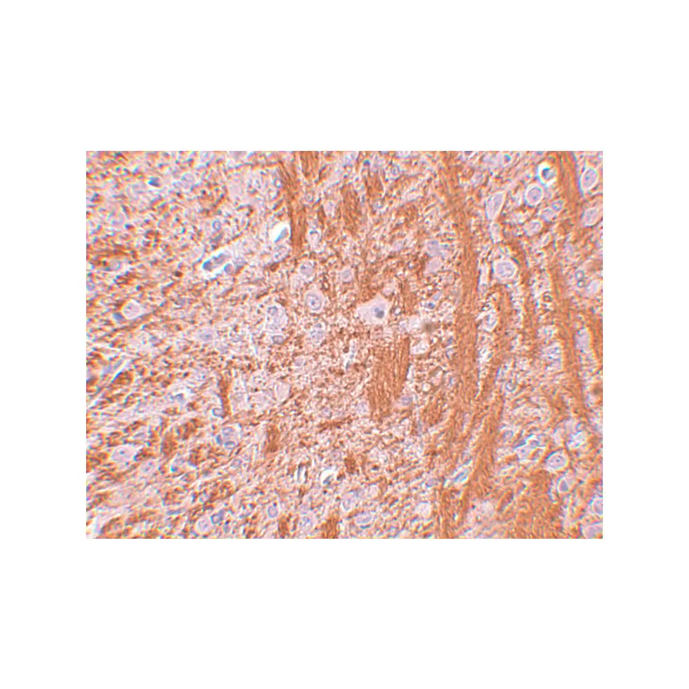 ProSci 5383 JMJD6 Antibody, ProSci, 0.1 mg/Unit Secondary Image