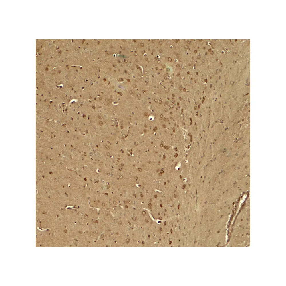 ProSci 8017_S KCNK1 Antibody, ProSci, 0.02 mg/Unit Secondary Image