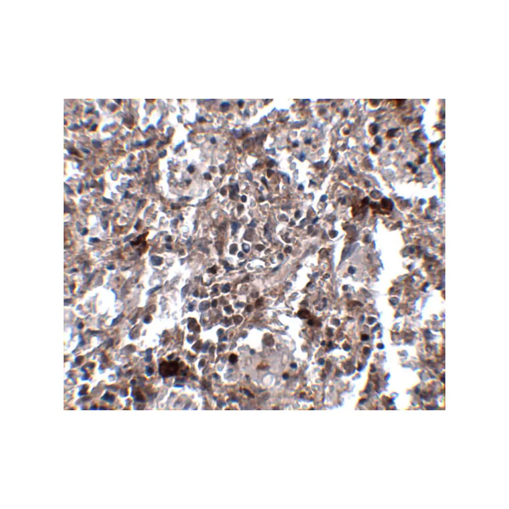 ProSci 5085_S KCTD15 Antibody, ProSci, 0.02 mg/Unit Secondary Image