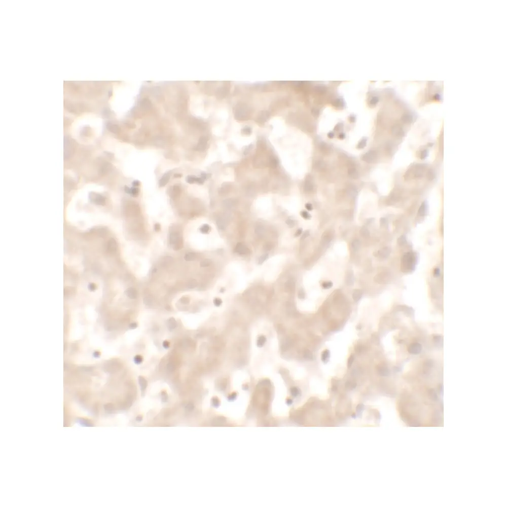 ProSci 7423 KHDC1 Antibody, ProSci, 0.1 mg/Unit Secondary Image