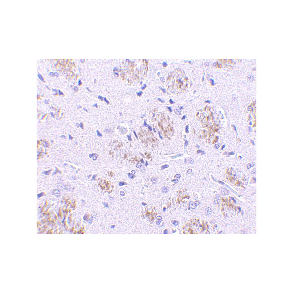 ProSci 3015_S KLHL1 Antibody, ProSci, 0.02 mg/Unit Secondary Image