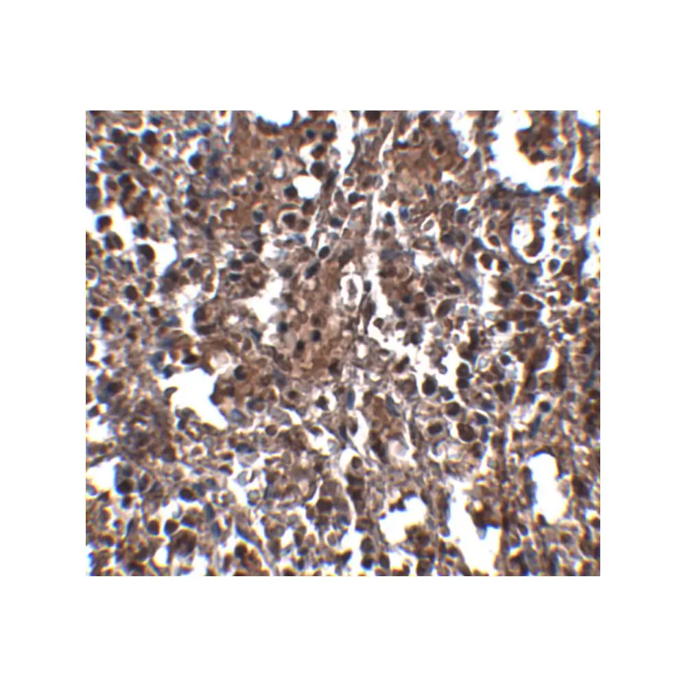 ProSci 5017_S KLRA2 Antibody, ProSci, 0.02 mg/Unit Secondary Image