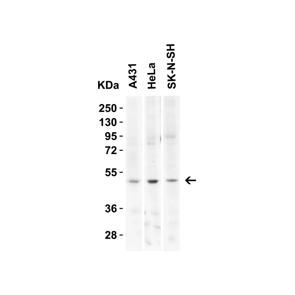 ProSci 7263_S KREMEN2 Antibody, ProSci, 0.02 mg/Unit Secondary Image