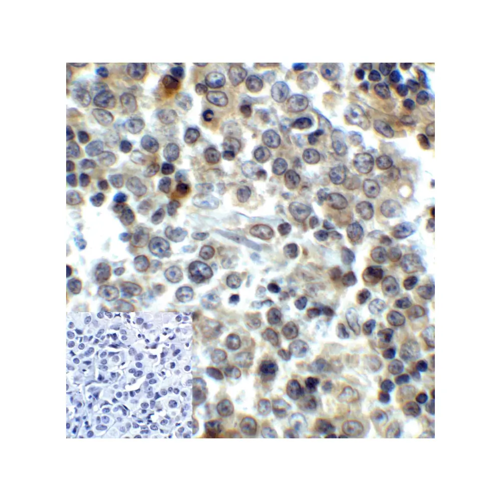 ProSci RF16086 LAG3 Antibody [6B12], ProSci, 0.1 mg/Unit Quaternary Image