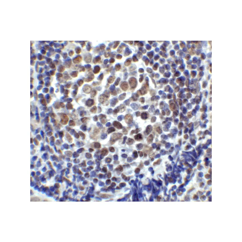 ProSci 8657 LAG3 Antibody, ProSci, 0.1 mg/Unit Secondary Image