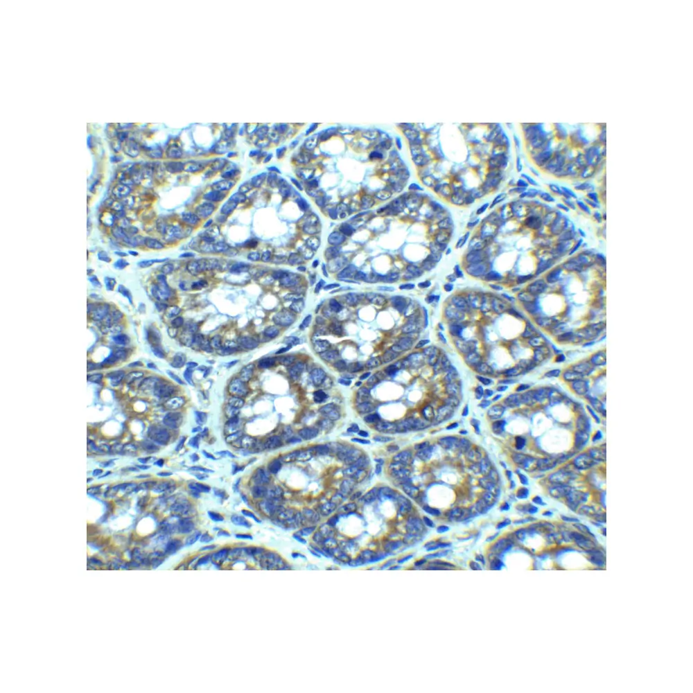 ProSci 3629 LAMP-1 Antibody, ProSci, 0.1 mg/Unit Quaternary Image
