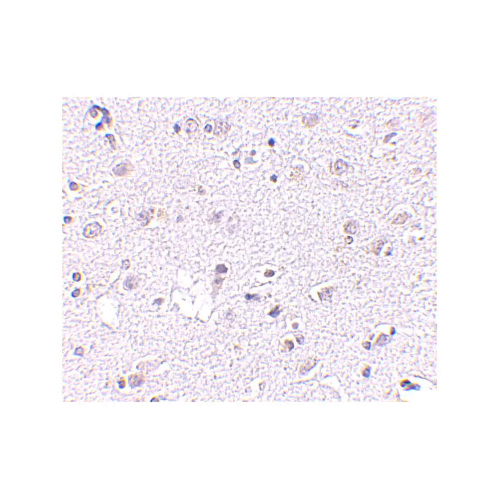ProSci 4697 LASS5 Antibody, ProSci, 0.1 mg/Unit Secondary Image
