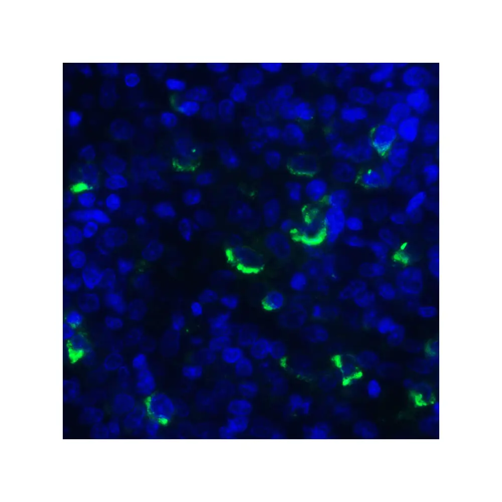 ProSci RF16061_S LIGHT Antibody [7B9F12], ProSci, 0.02 mg/Unit Quaternary Image