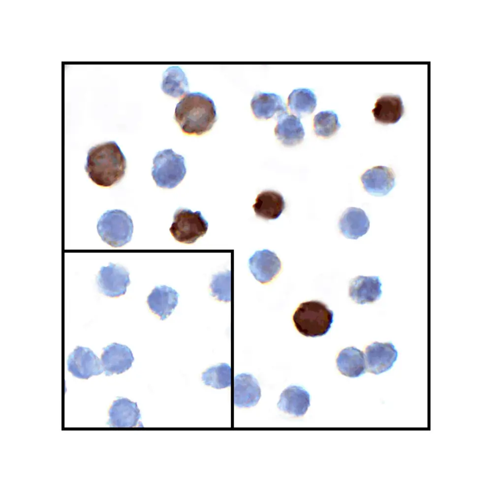 ProSci RF16062 LIGHT Antibody [7B9H9], ProSci, 0.1 mg/Unit Secondary Image