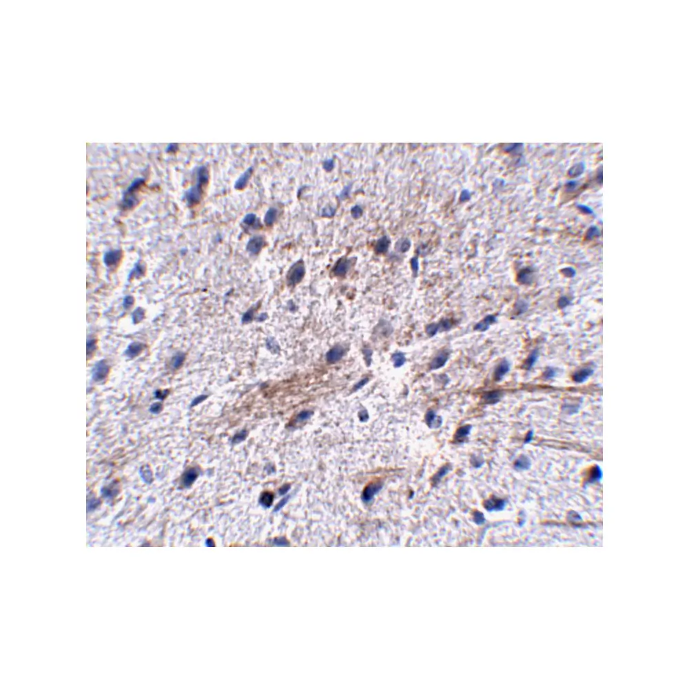 ProSci 5079_S LRFN5 Antibody, ProSci, 0.02 mg/Unit Secondary Image