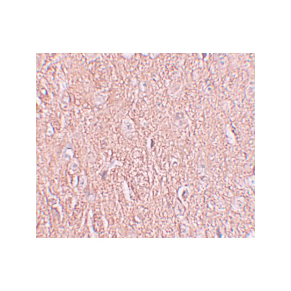 ProSci 6169 LRRTM2 Antibody, ProSci, 0.1 mg/Unit Secondary Image