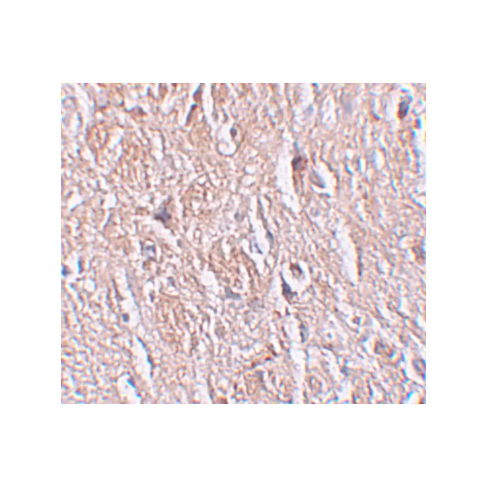 ProSci 6173 LRRTM4 Antibody, ProSci, 0.1 mg/Unit Secondary Image