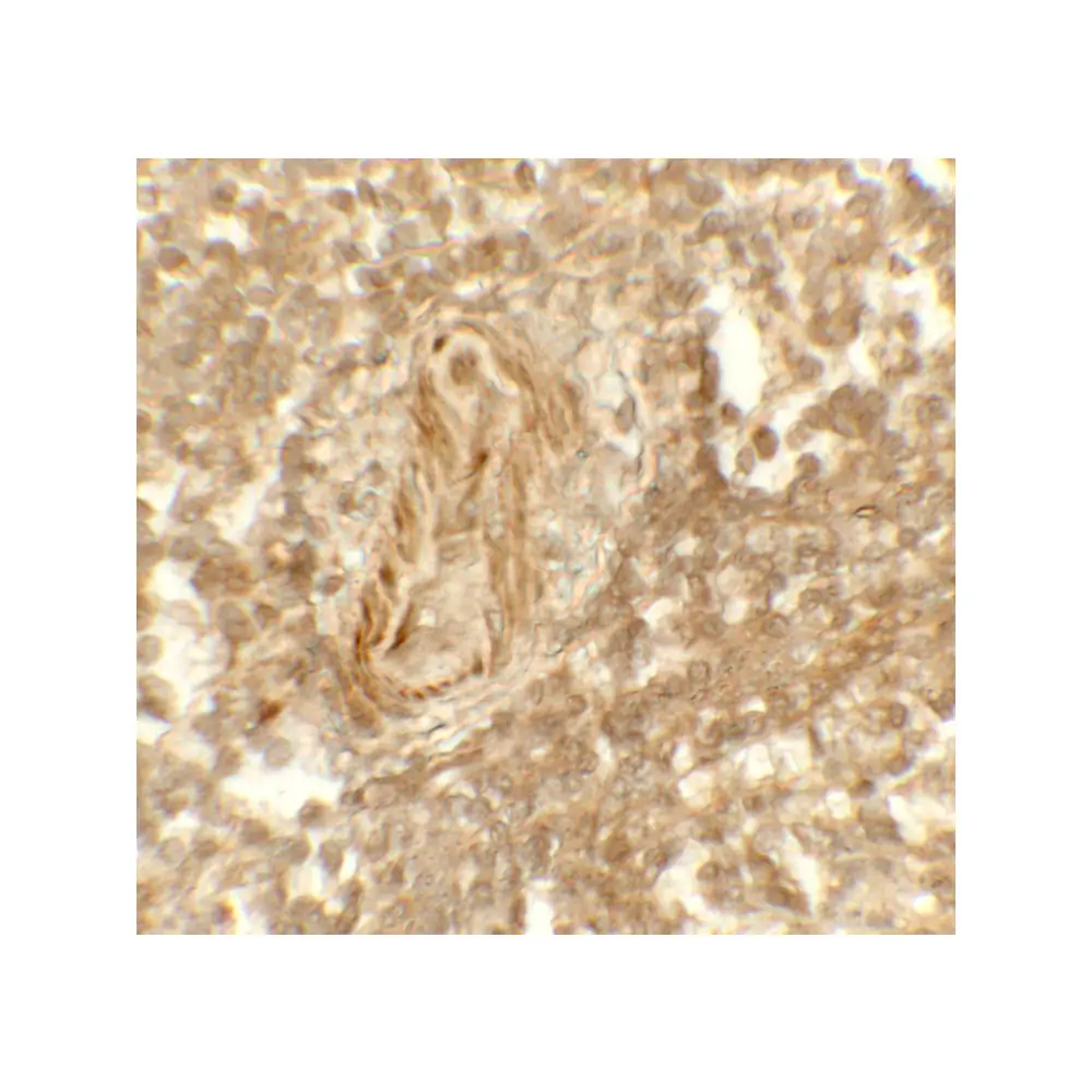 ProSci 8223_S LSD1 Antibody, ProSci, 0.02 mg/Unit Tertiary Image