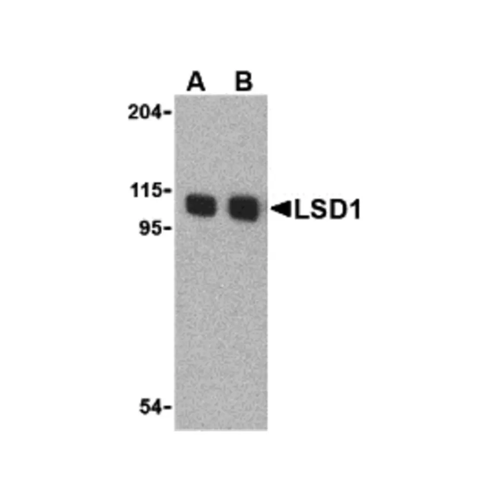 ProSci 3761 LSD1 Antibody, ProSci, 0.1 mg/Unit Quaternary Image