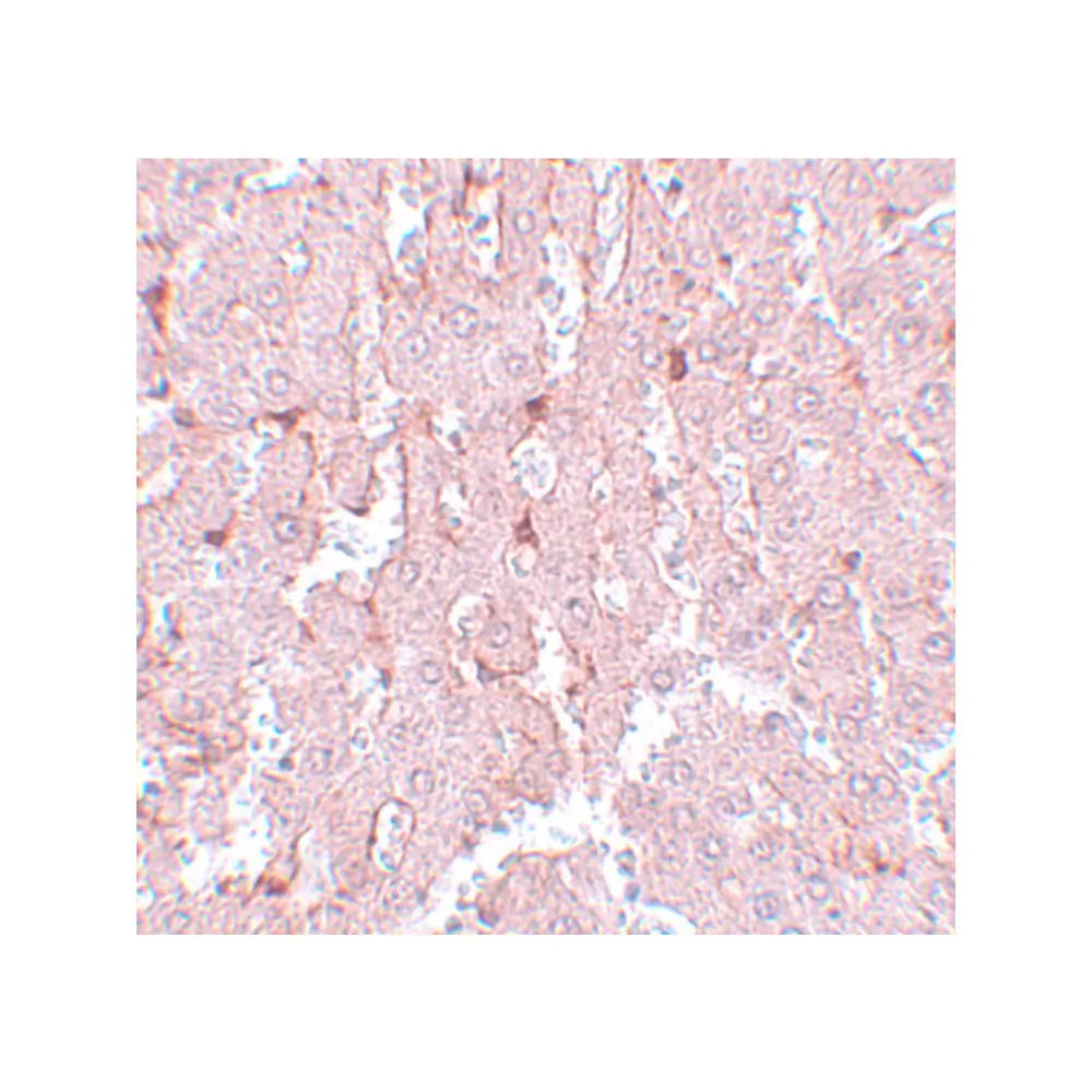 ProSci 5577 LXR-A Antibody, ProSci, 0.1 mg/Unit Secondary Image