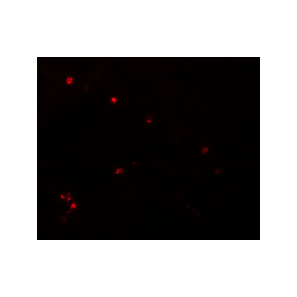 ProSci 5663 LYRM3 Antibody, ProSci, 0.1 mg/Unit Tertiary Image