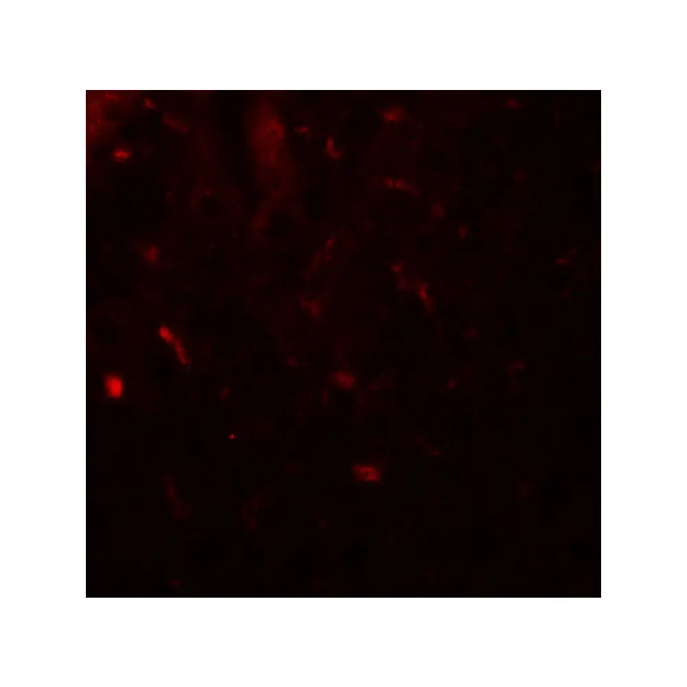 ProSci 8097 MALT1 Antibody, ProSci, 0.1 mg/Unit Tertiary Image