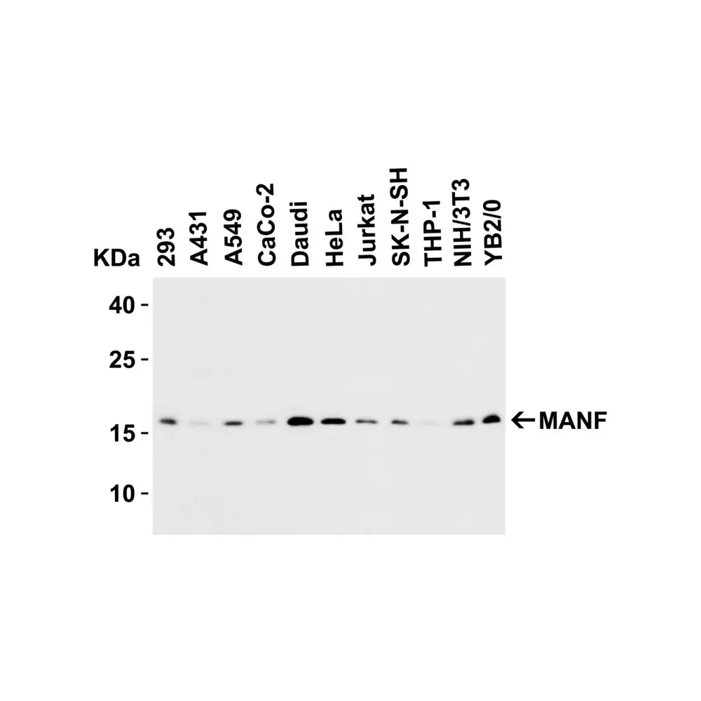 ProSci 4347 MANF Antibody, ProSci, 0.1 mg/Unit Secondary Image