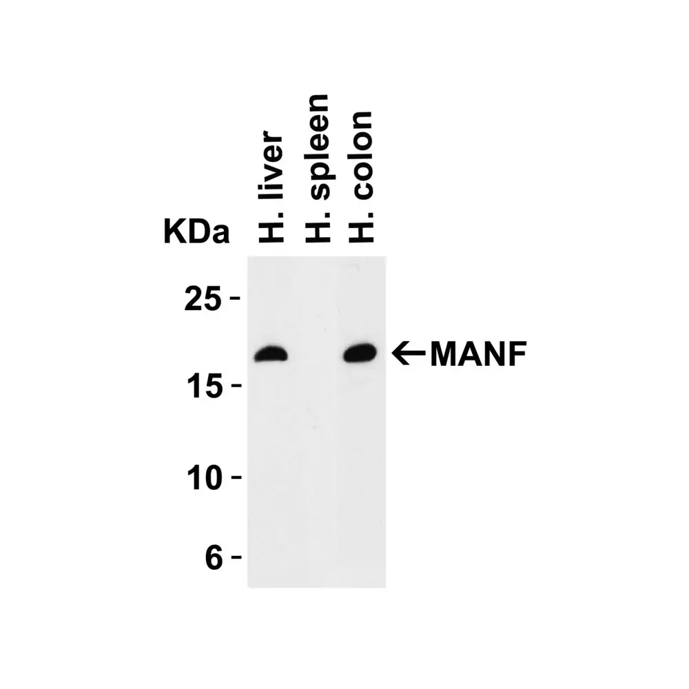 ProSci 4347 MANF Antibody, ProSci, 0.1 mg/Unit Quaternary Image