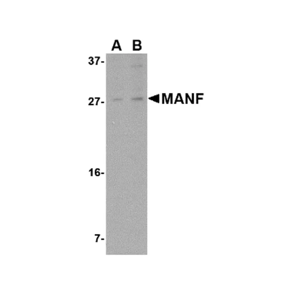 ProSci 4349_S MANF Antibody, ProSci, 0.02 mg/Unit Tertiary Image