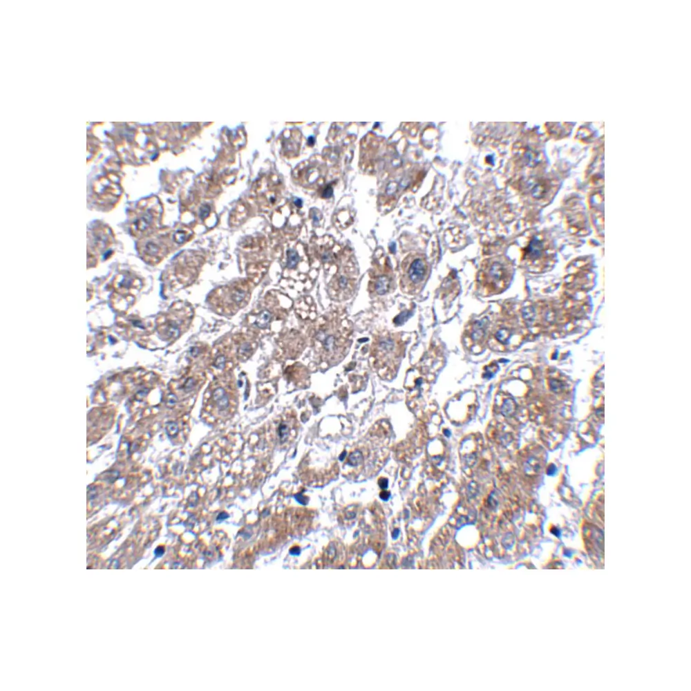 ProSci 5125_S MATN1 Antibody, ProSci, 0.02 mg/Unit Secondary Image