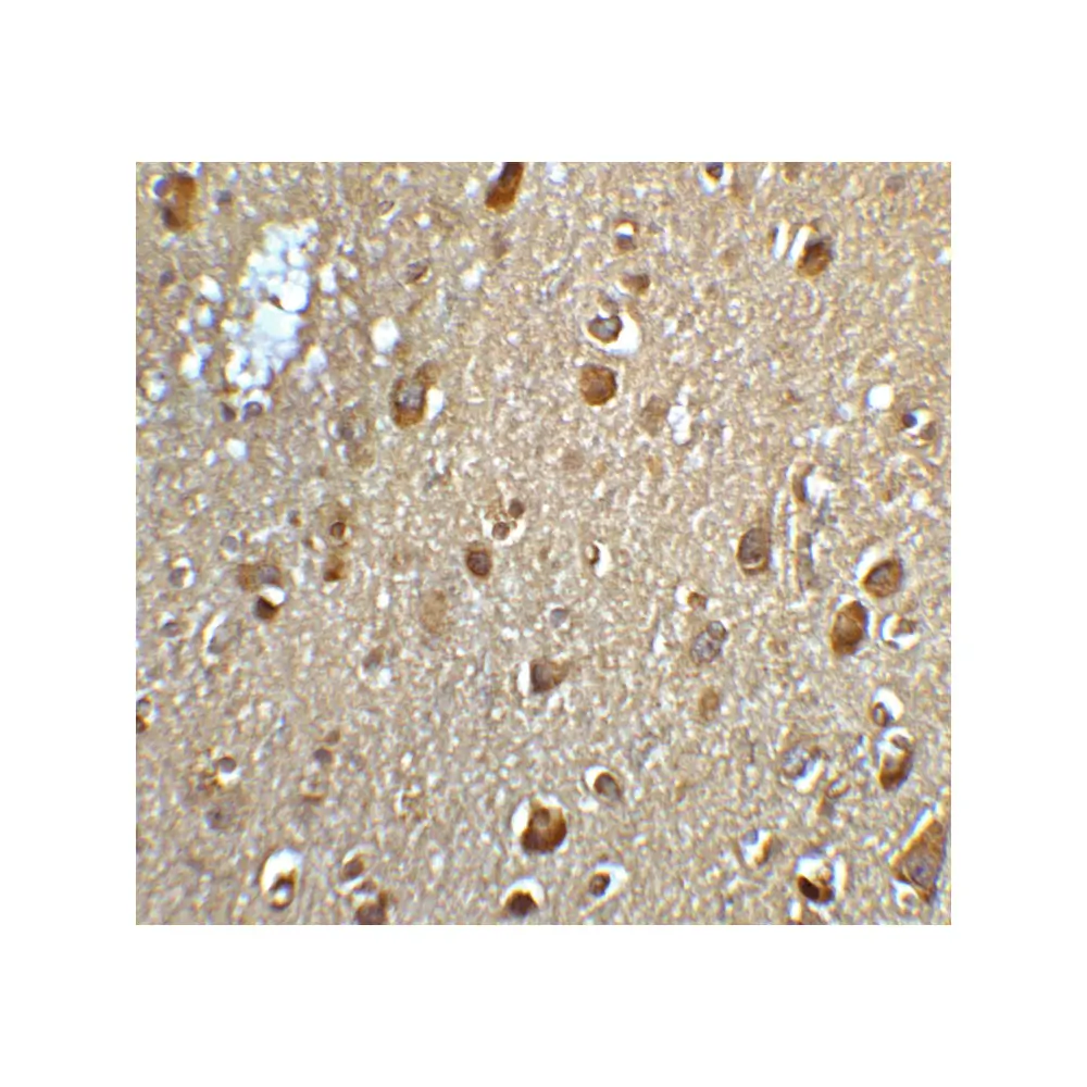 ProSci 6025_S MFSD2A Antibody, ProSci, 0.02 mg/Unit Senary Image