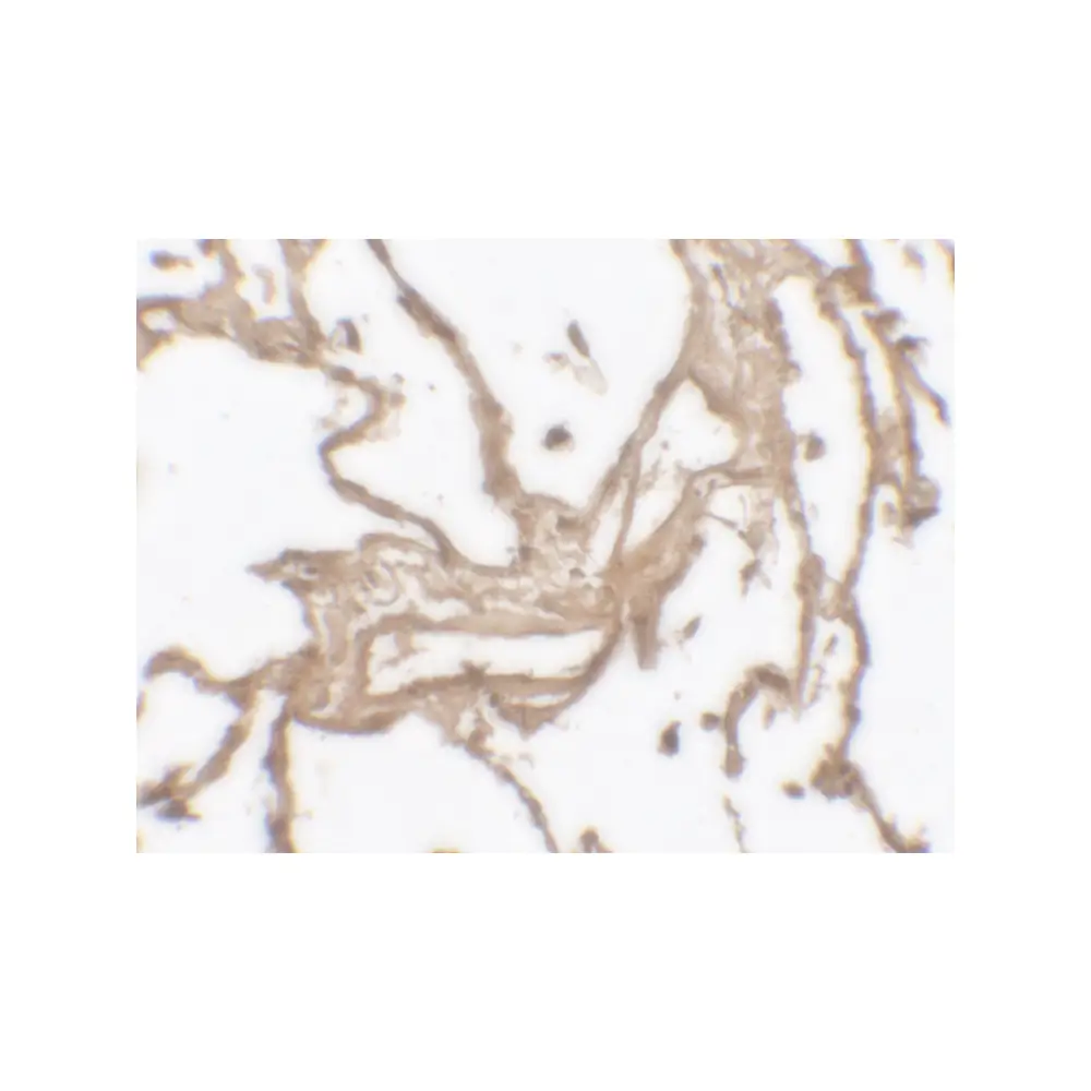 ProSci 7471_S MMP9 Antibody , ProSci, 0.02 mg/Unit Secondary Image