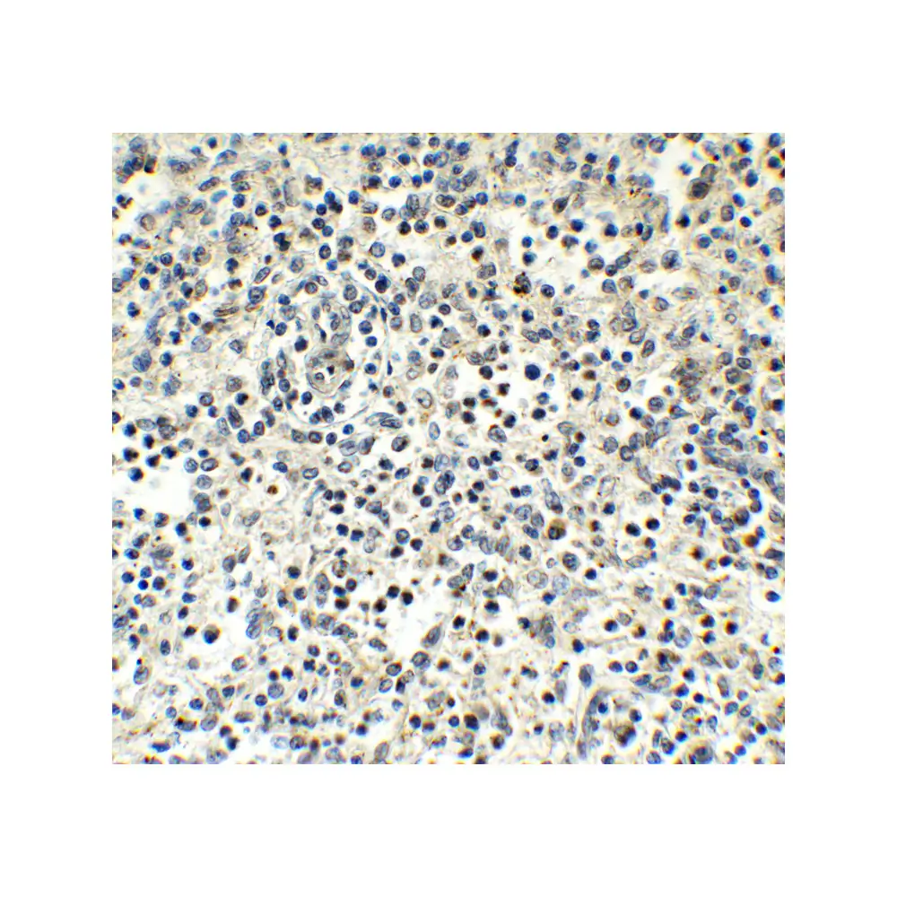 ProSci 9645 MNDA (CT) Antibody, ProSci, 0.1 mg/Unit Secondary Image