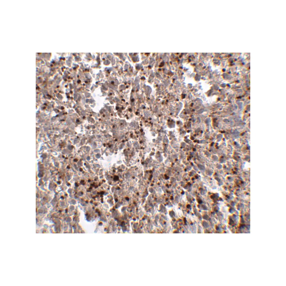 ProSci 4881_S MettL7B Antibody, ProSci, 0.02 mg/Unit Secondary Image