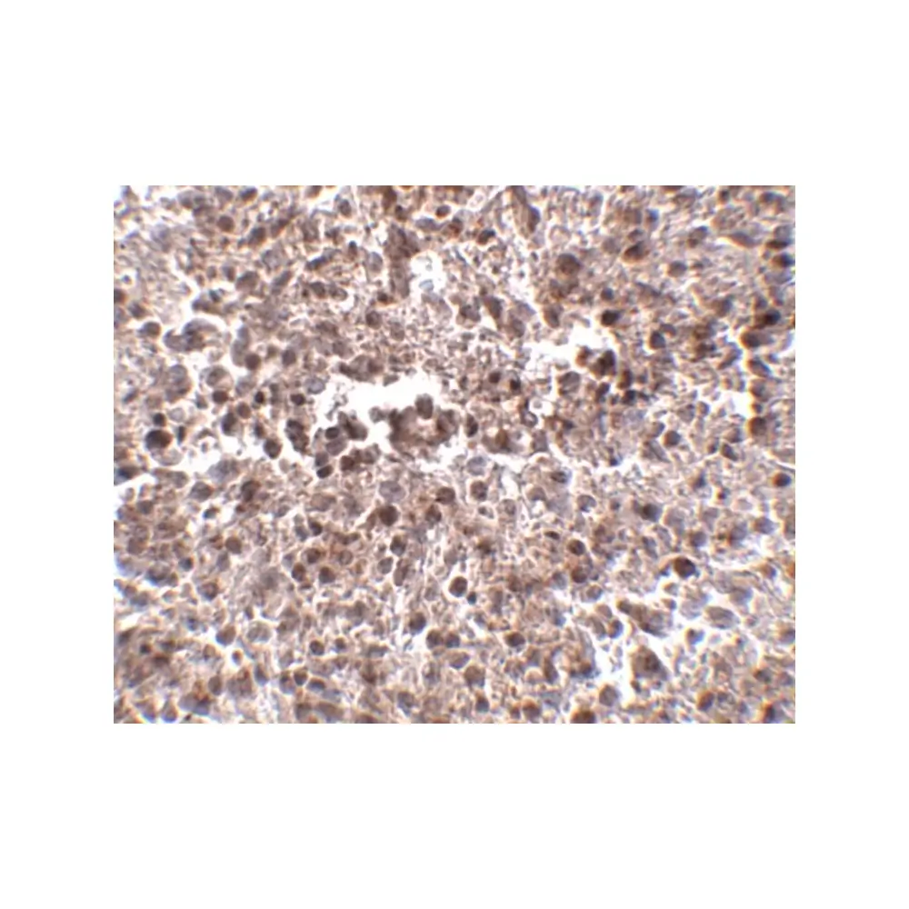 ProSci 4891 MettL7B Antibody, ProSci, 0.1 mg/Unit Secondary Image