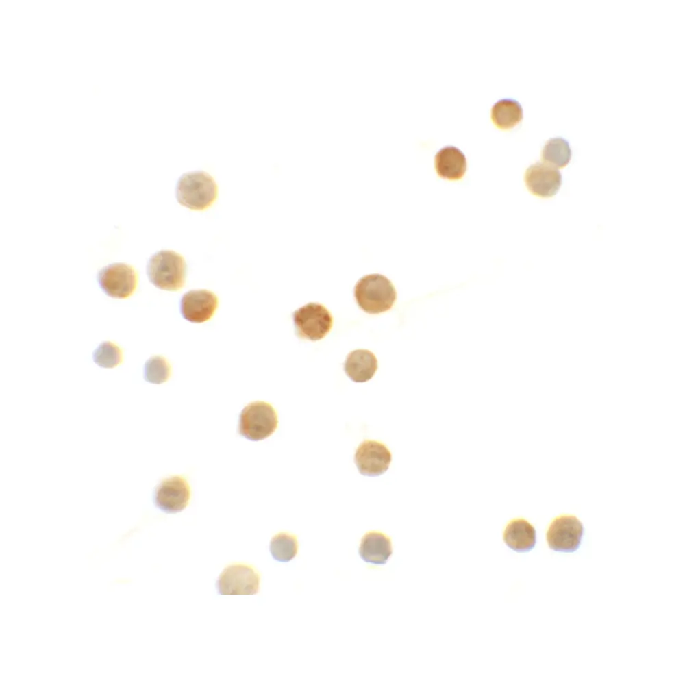 ProSci 6175 N4BP1 Antibody, ProSci, 0.1 mg/Unit Secondary Image