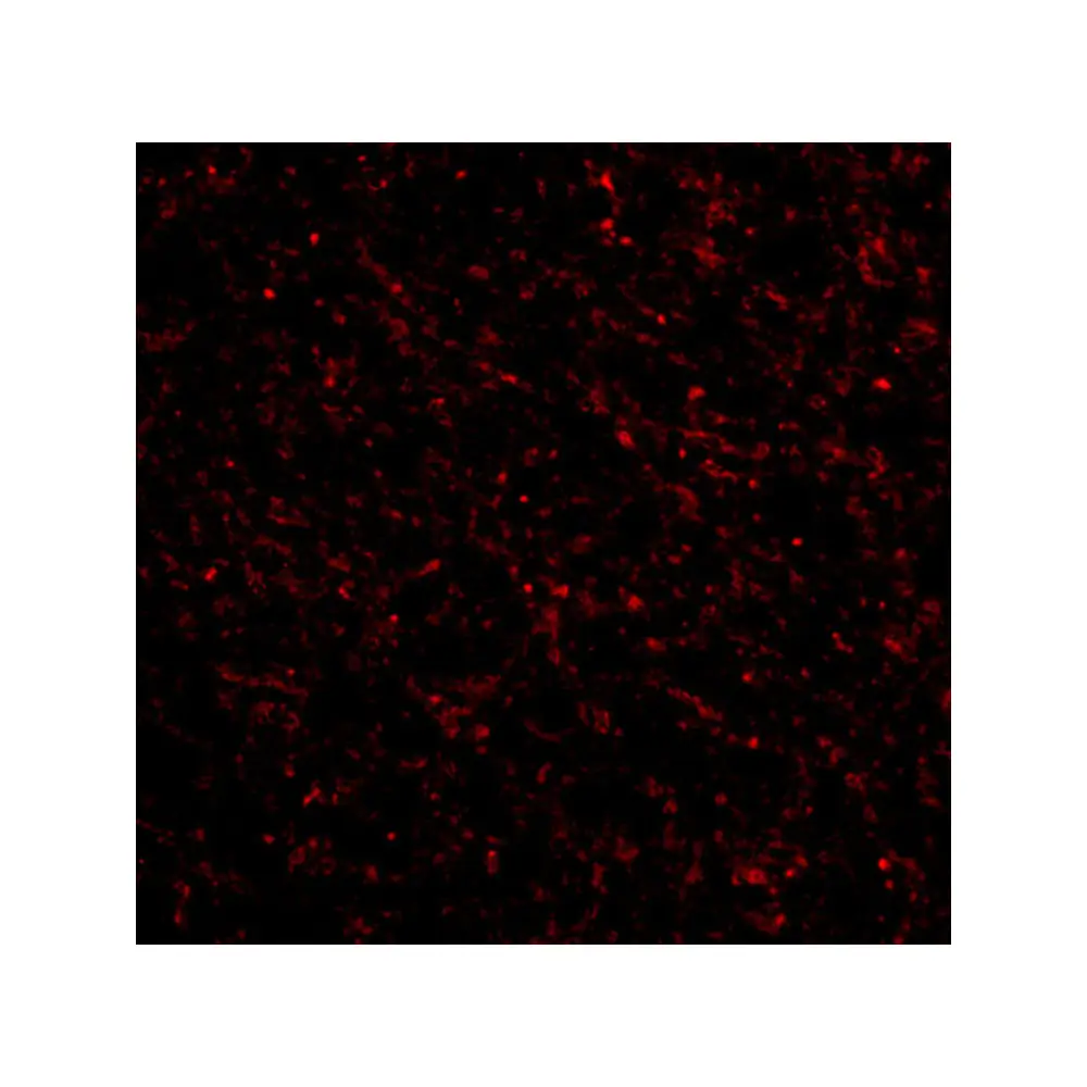 ProSci 4255 NK3R Antibody, ProSci, 0.1 mg/Unit Tertiary Image