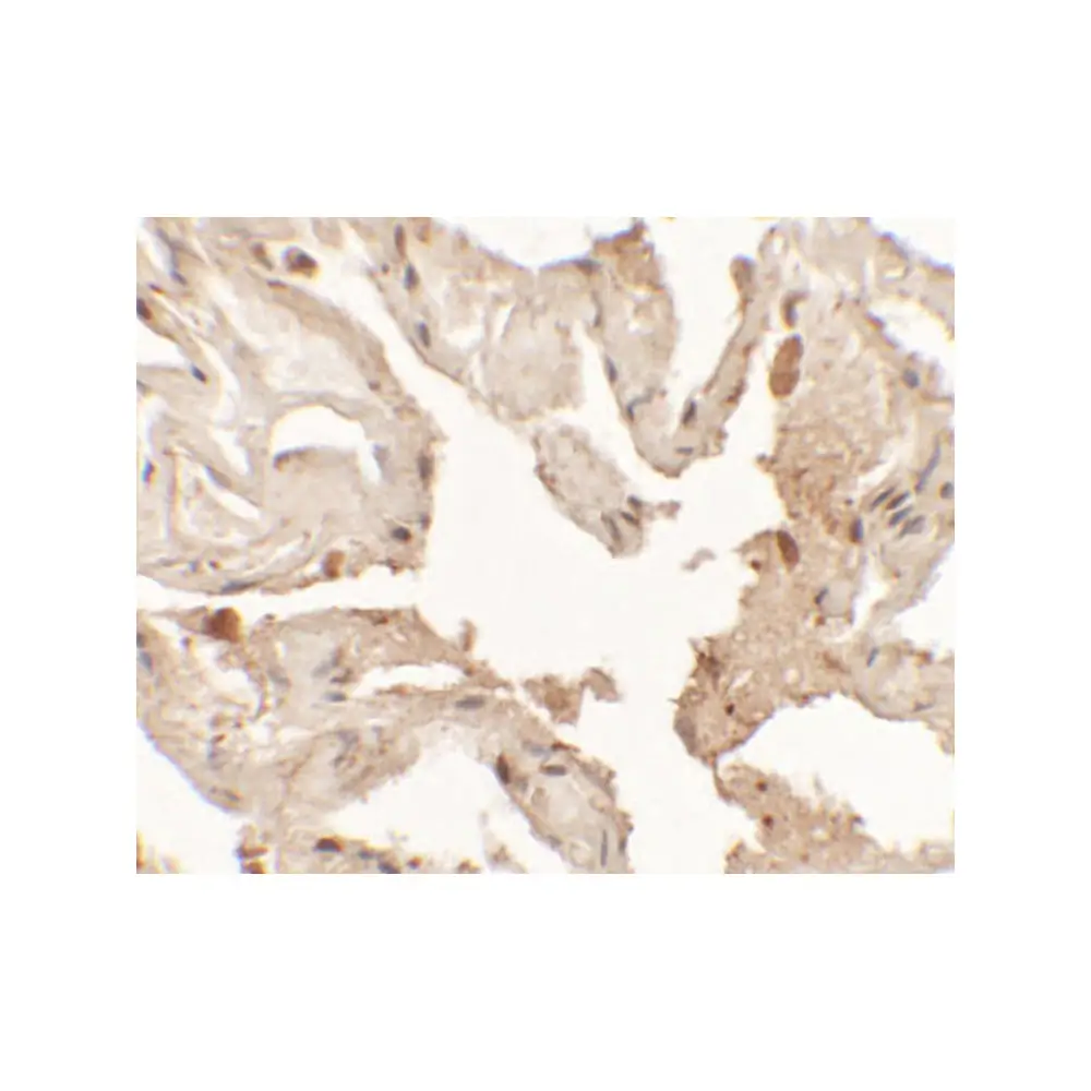 ProSci 6741 NKX2-1 Antibody, ProSci, 0.1 mg/Unit Secondary Image