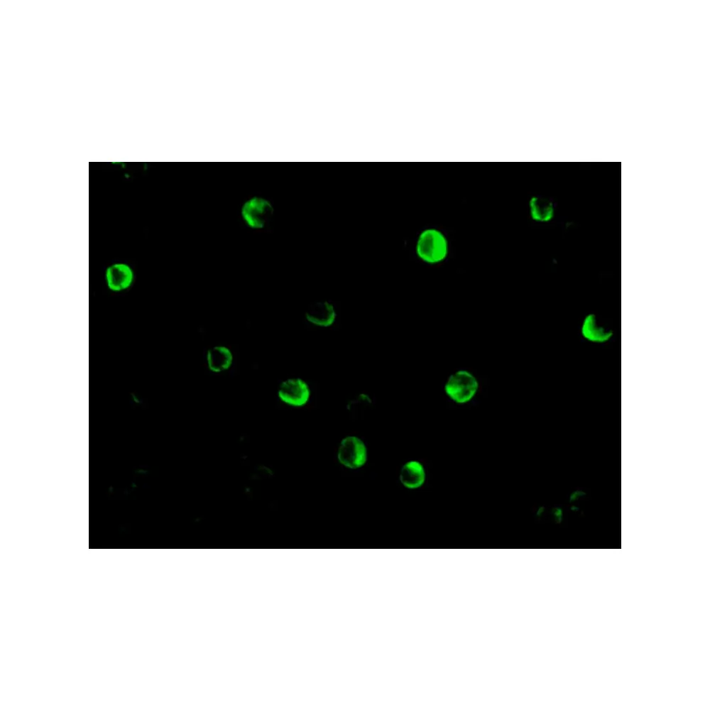 ProSci 2513 NOD2 Antibody, ProSci, 0.1 mg/Unit Tertiary Image