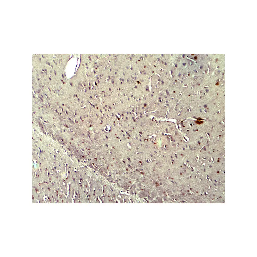 ProSci 7923_S NOX2 Antibody, ProSci, 0.02 mg/Unit Secondary Image
