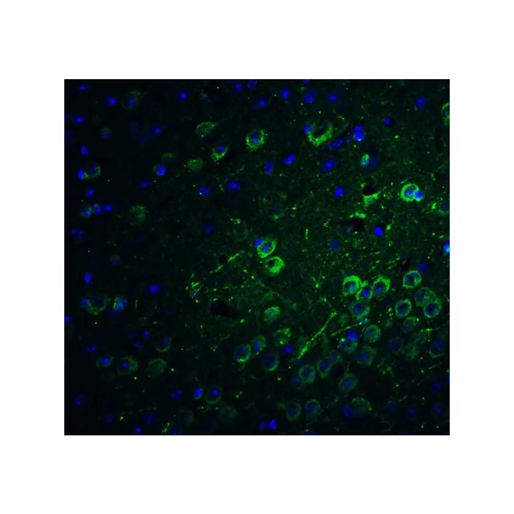 ProSci 8187 PACS1 Antibody, ProSci, 0.1 mg/Unit Quaternary Image