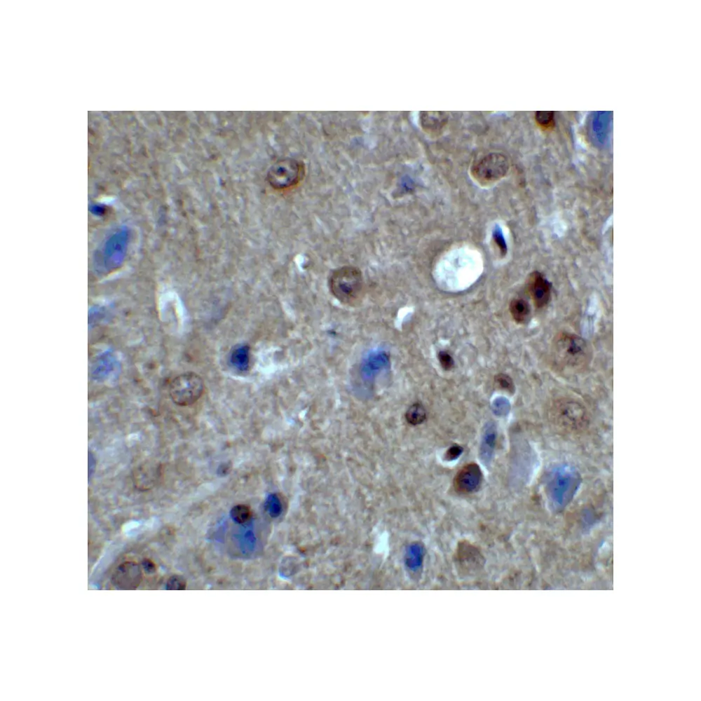 ProSci 8187 PACS1 Antibody, ProSci, 0.1 mg/Unit Secondary Image