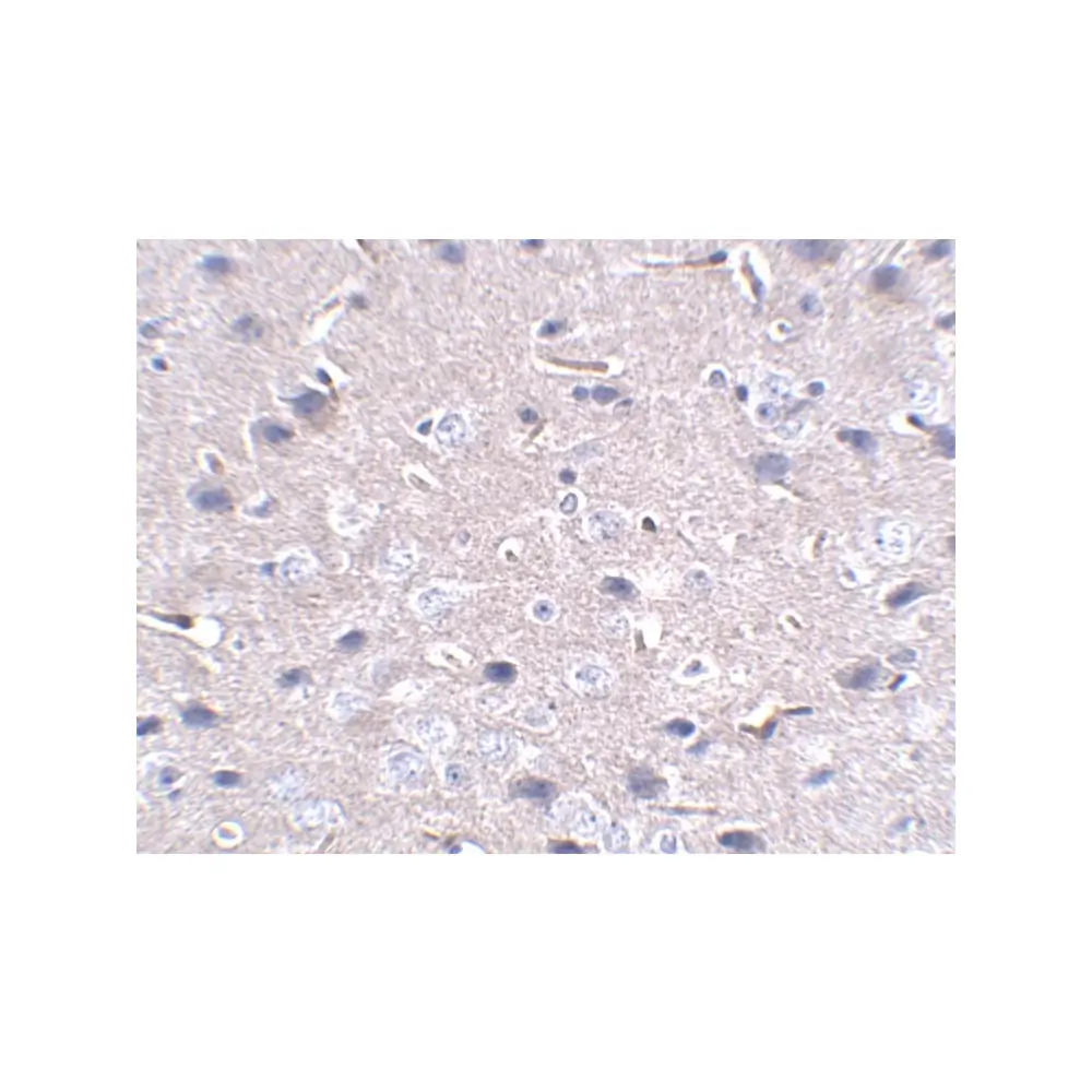 ProSci PM-5179_S PD-1 Antibody [12A7D7] , ProSci, 0.02 mg/Unit Secondary Image