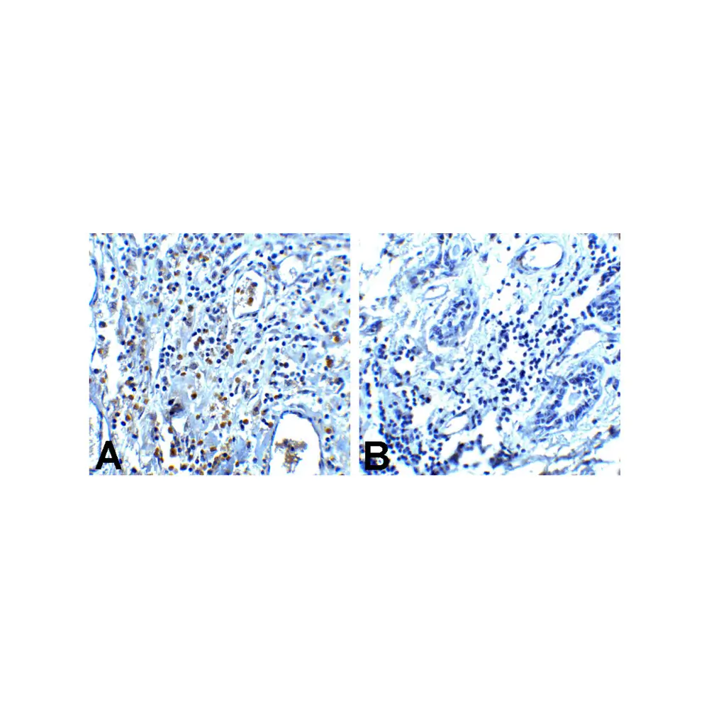 ProSci RF16003 PD1 Antibody [7H6], ProSci, 0.1 mg/Unit Tertiary Image