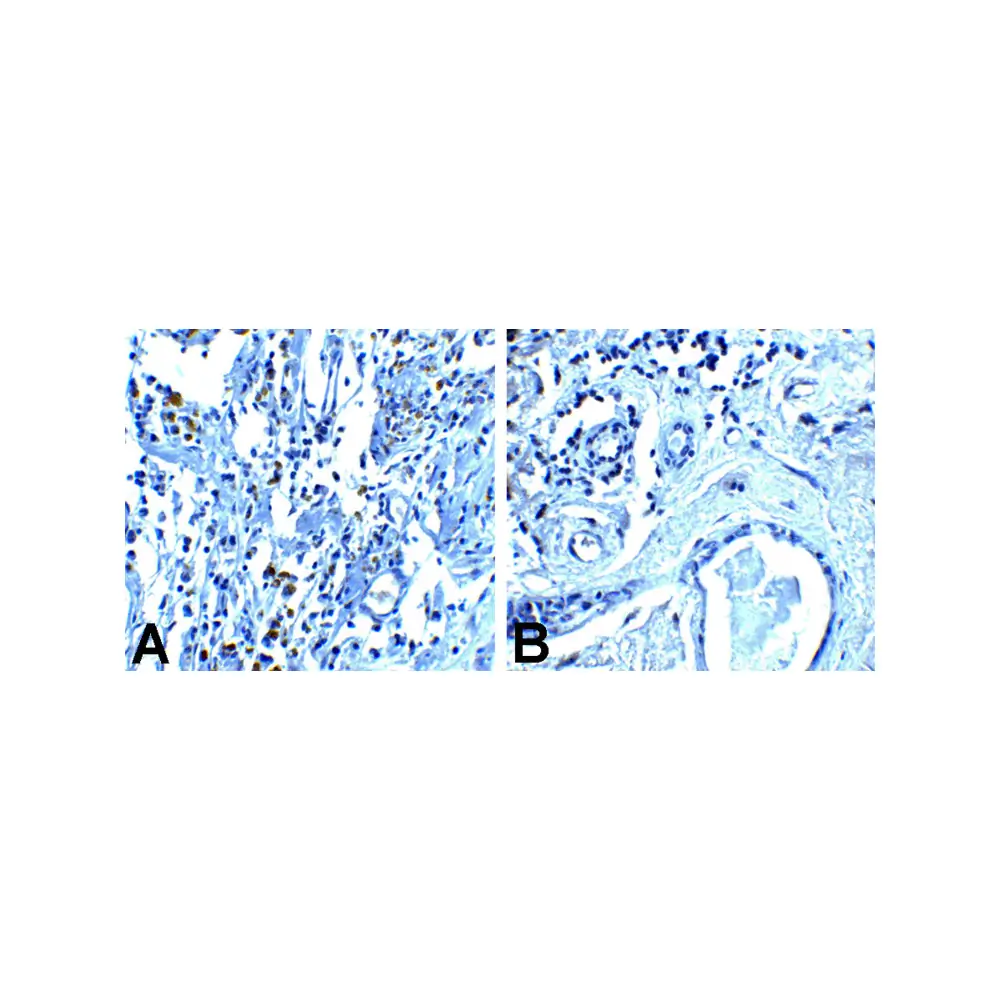 ProSci RF16002 PD1 Antibody [8A4], ProSci, 0.1 mg/Unit Tertiary Image