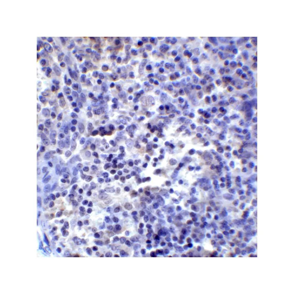 ProSci RF16023 PDL2 Antibody [7C7], ProSci, 0.1 mg/Unit Senary Image