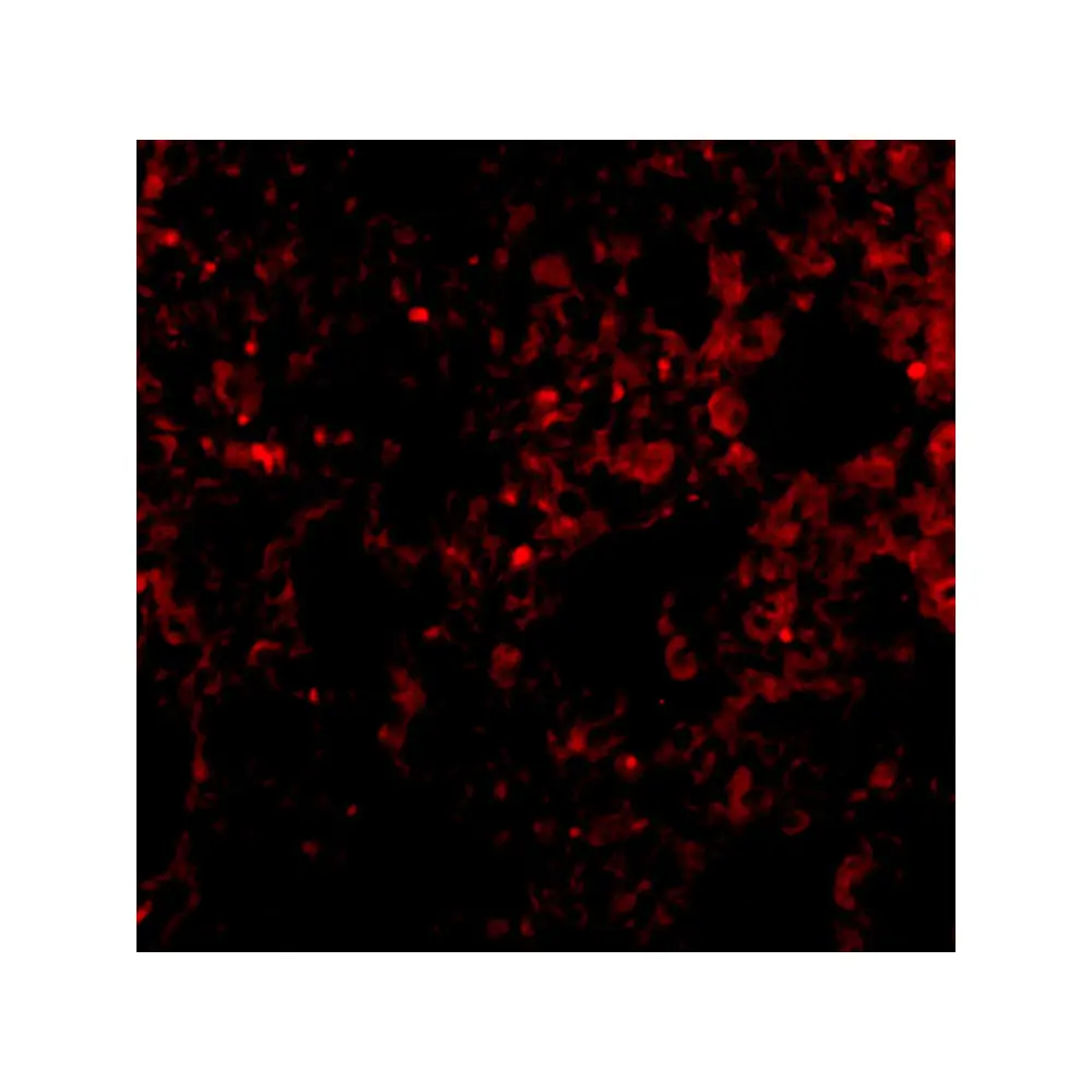 ProSci 3981 PEN2 Antibody, ProSci, 0.1 mg/Unit Tertiary Image