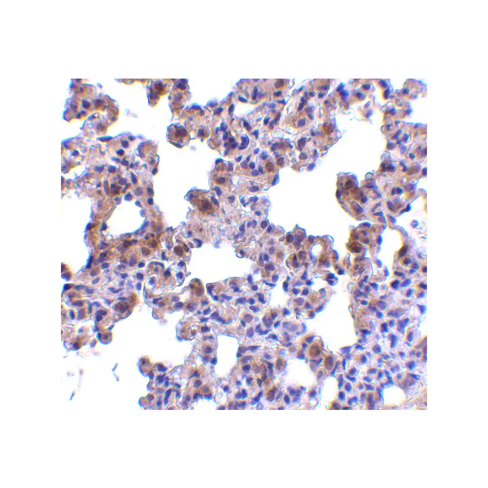 ProSci 3981 PEN2 Antibody, ProSci, 0.1 mg/Unit Secondary Image